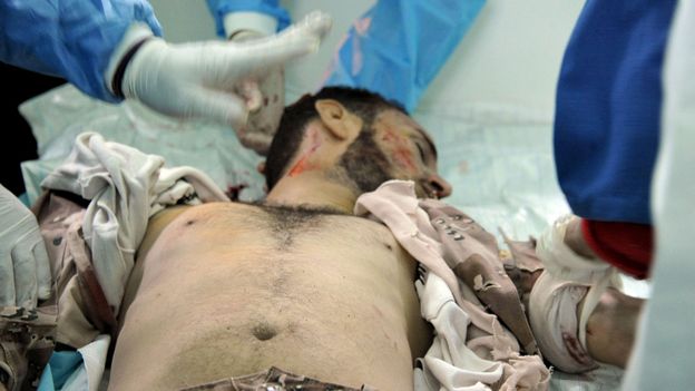 Un Libyen blessé (image d'illustration)