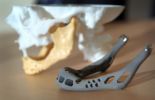 1ère greffe de mâchoire avec imagerie 3D, par une équipe belgo-néerlandaise