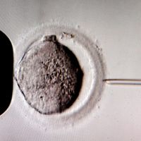 Une micro-injection de spermatozoïdes dans une cellule