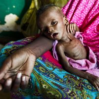 Yunis, un bébé somalien de quatre mois affamé, dans les bras de sa mère.